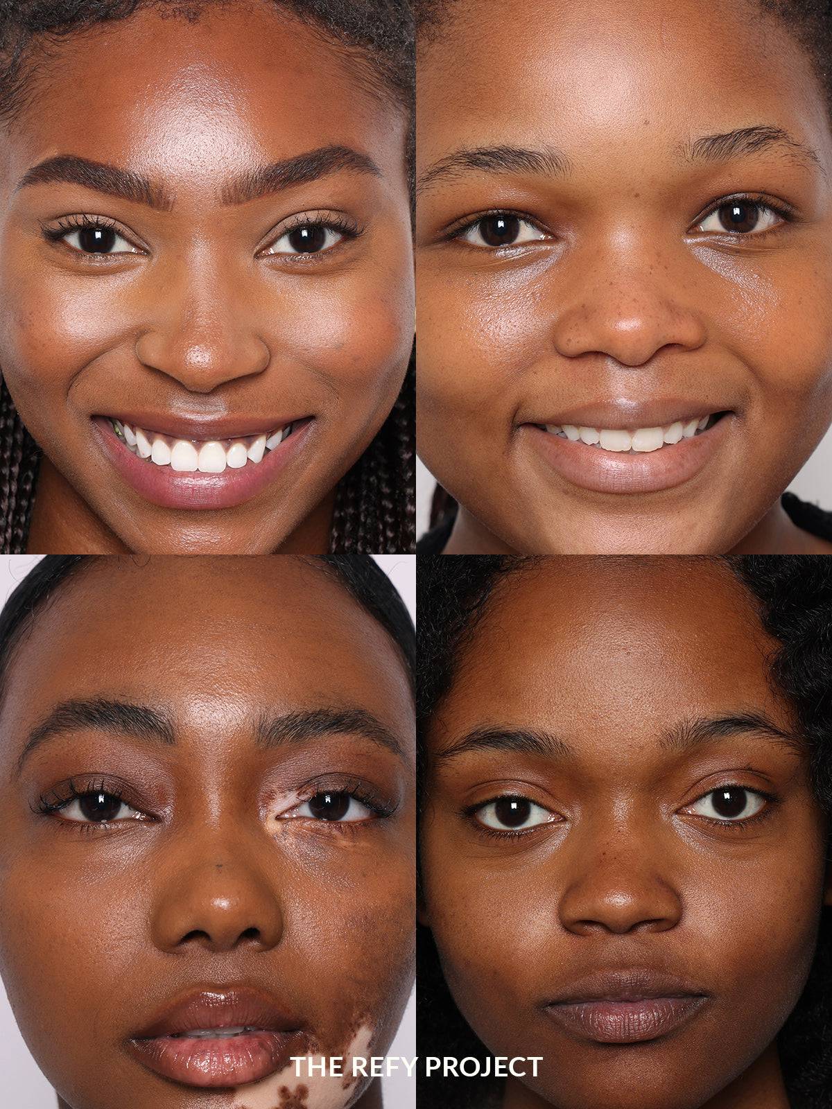 Refy Concealer - Kapatıcı