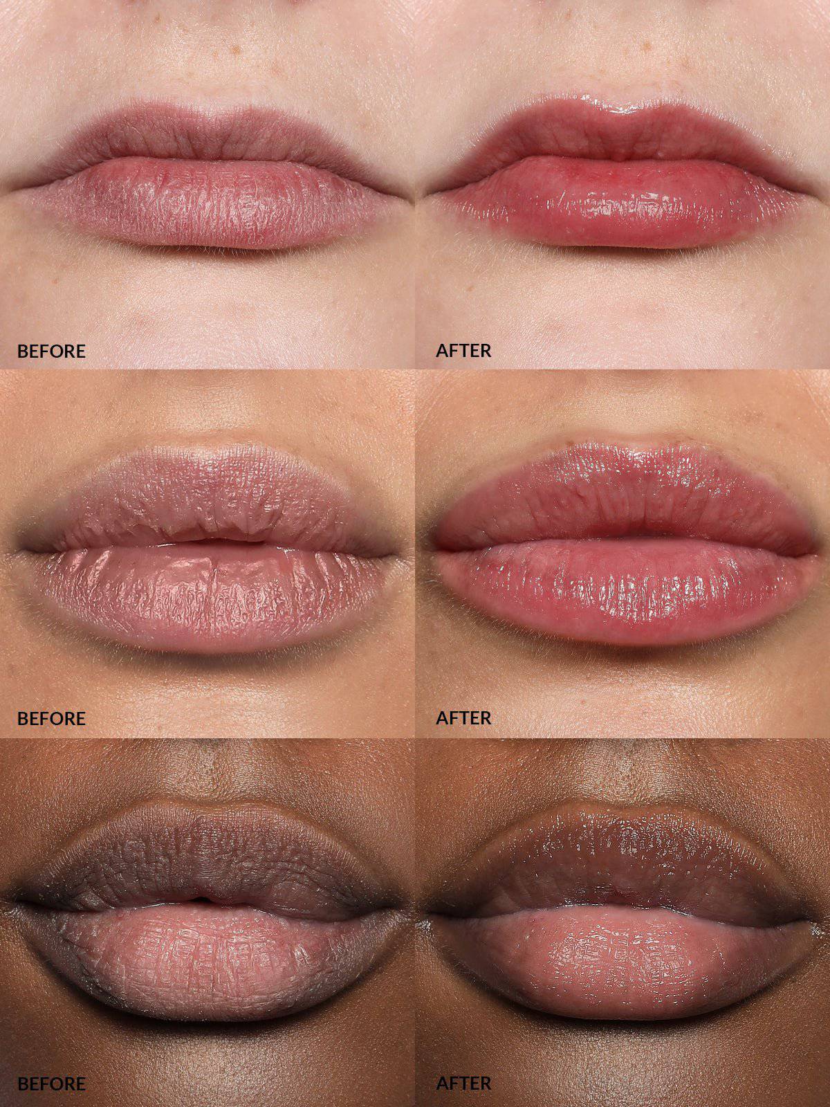 Refy Lip Buff - Dudak Dolgunlaştırıcı