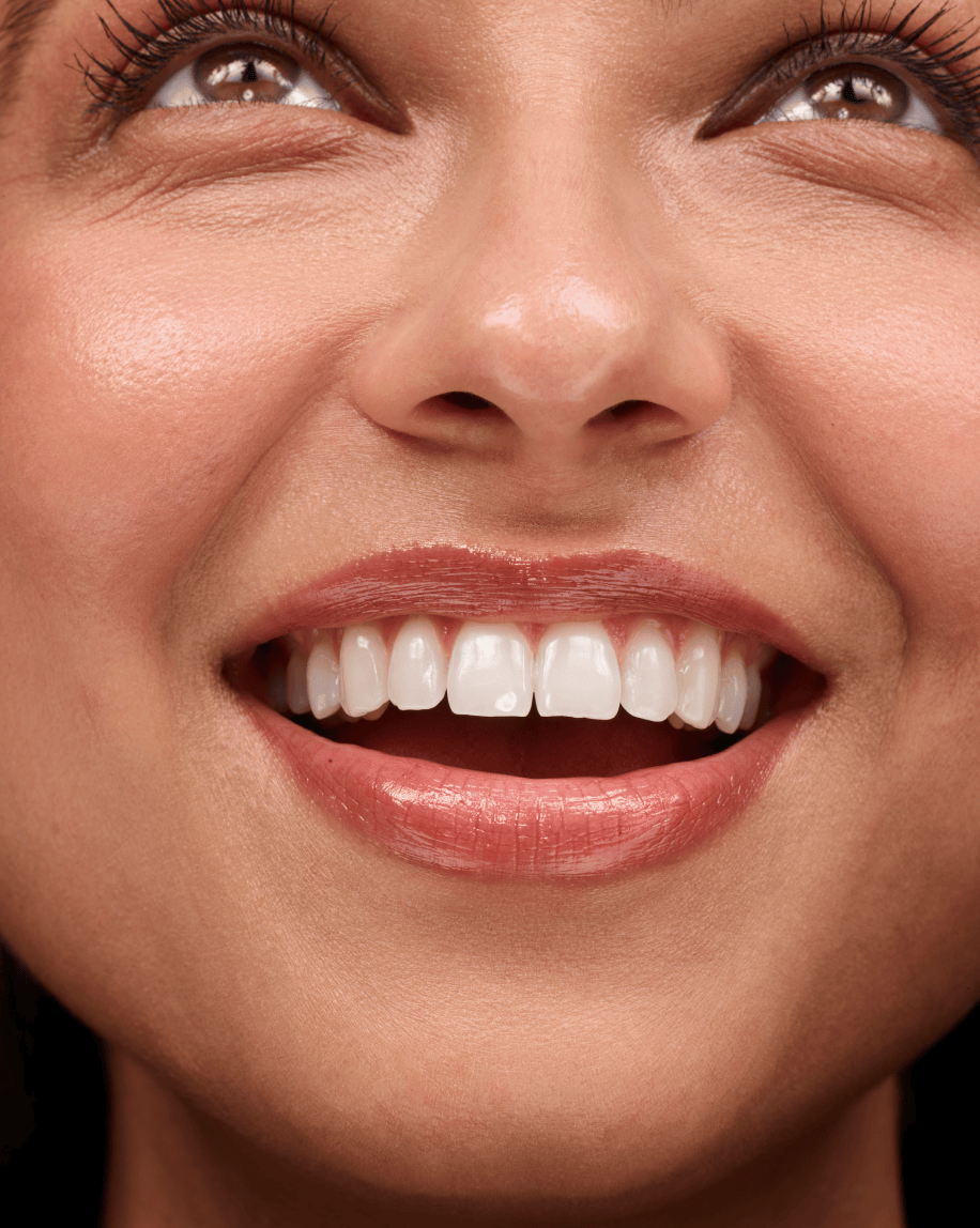 Glossier Ultralip - Lip Gloss